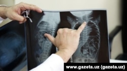 Рентгеновский снимок, сделанный 11-месячному младенцу, в теле которого обнаружили 16 швейных игл.