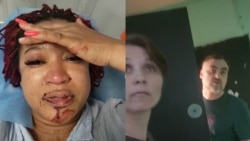 Темнокожая россиянка заявила об избиении соседями