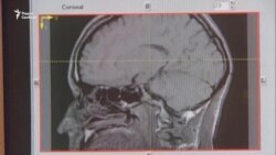 Дилеммы нейроэтики. Как сохранить мозг и личность?