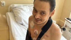 Ільля Жалезьнякоў у шпіталі неўзабаве пасьля перасадкі сэрца, архіўнае фота