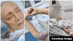 Султанбай Айжигитов ооруканадан салган сүрөттөр.