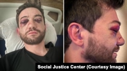 Саба Кевхішвілі, один із протестувальників, заарештований і побитий під час проєвропейської демонстрації в Грузії