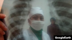 Кыргызстан кургак учукка чалдыккандар боюнча 213 өлкөнүн ичинен 72 орунда турат. 